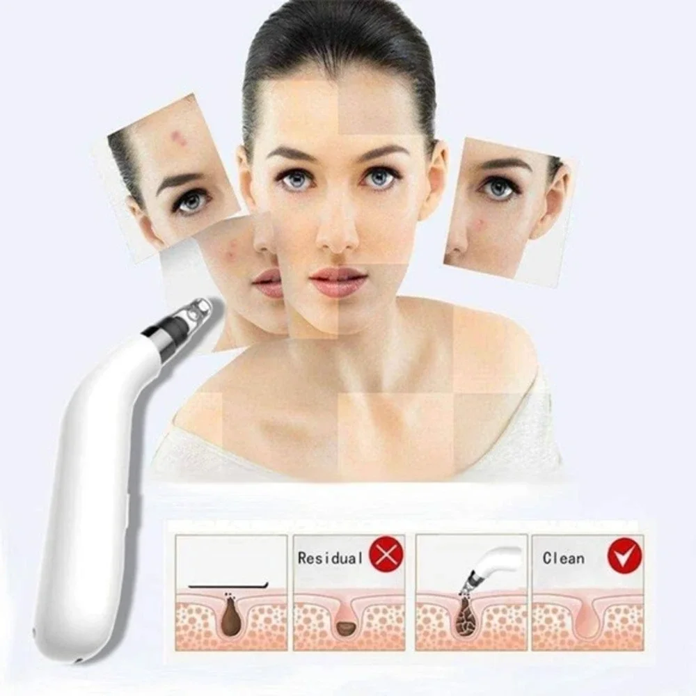 KAABETO blackhead electric